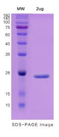 SDS-PAGE (PRTN3-6019H).jpg